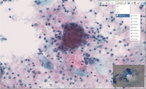 Read more about the article A Practical Guide to Whole Slide Imaging A White Paper From the Digital Pathology Association